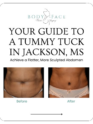 graphic showing before and after photo of patient tummy tuck results in Jackson, MS